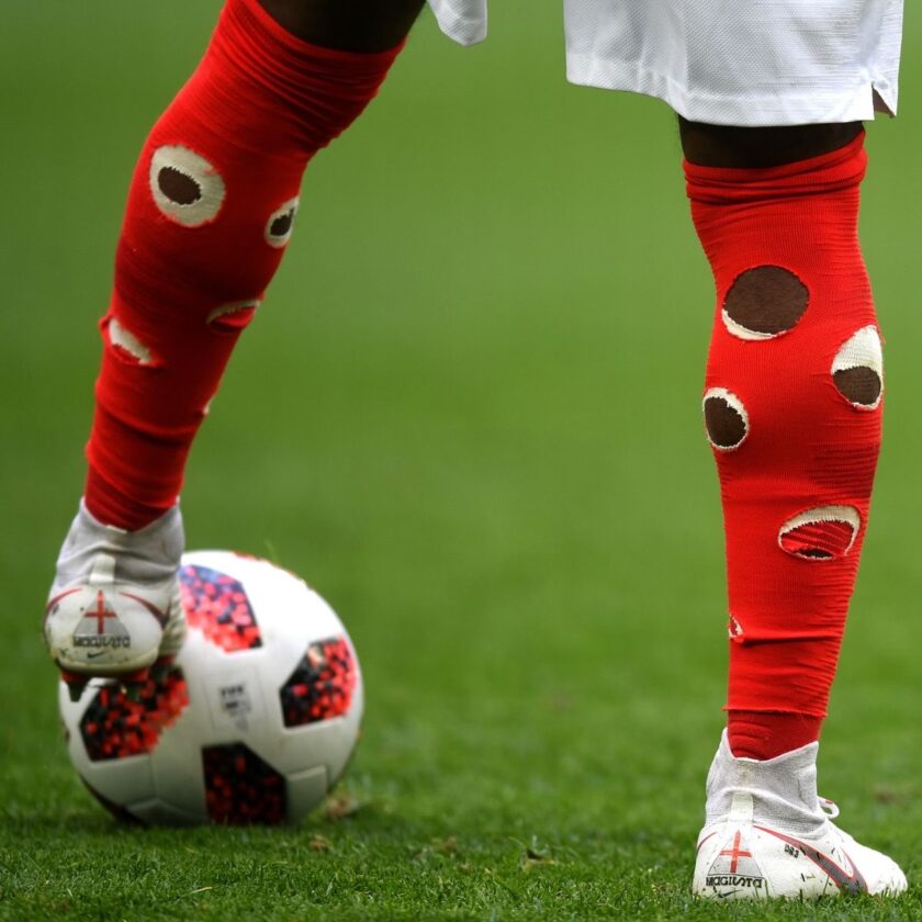Why Do Footballers Cut Holes in Their Socks?